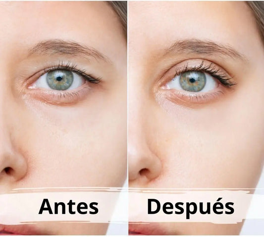 PerfectLift® – Recupera tu mirada, tu confianza y tu juventud