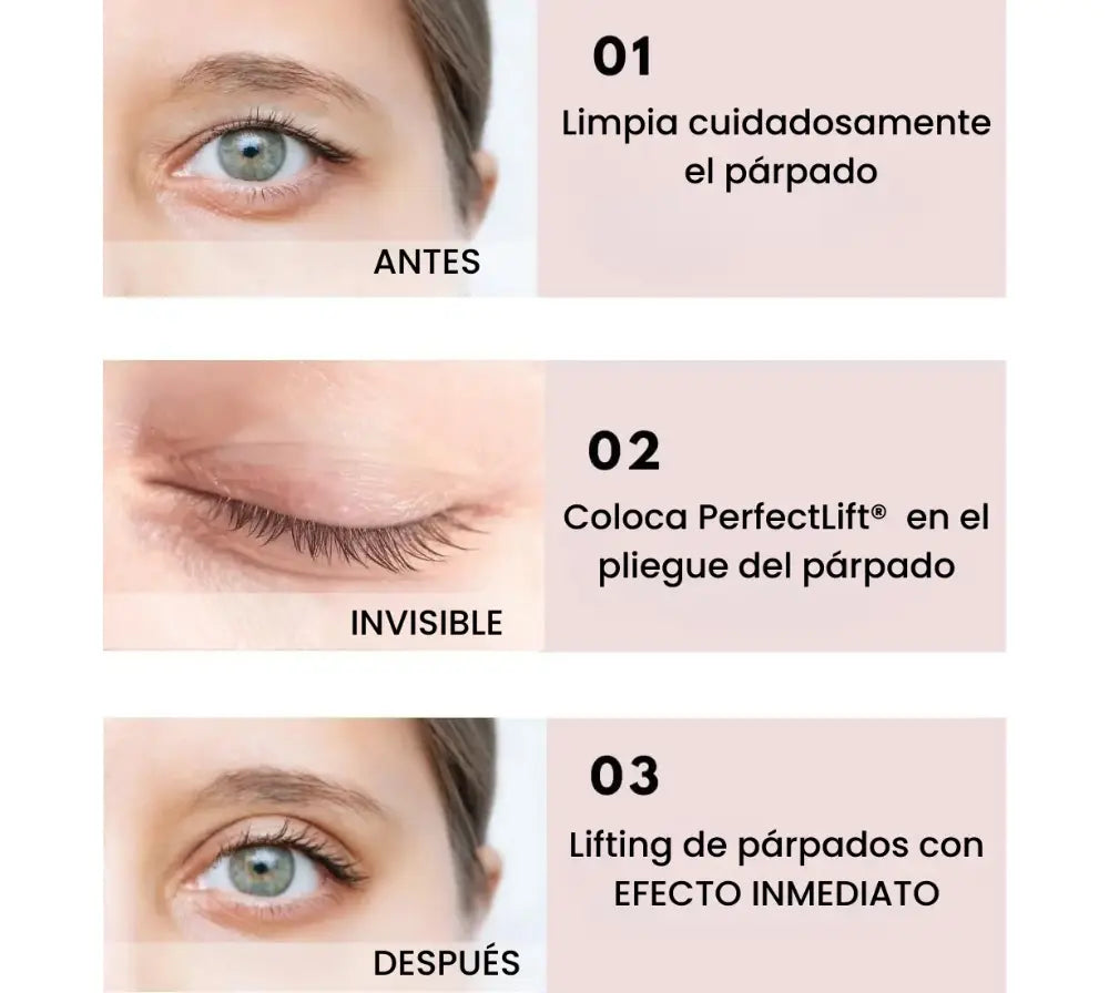 PerfectLift® – Recupera tu mirada, tu confianza y tu juventud