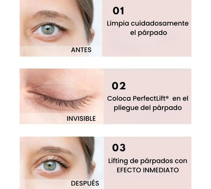 PerfectLift® – Recupera tu mirada, tu confianza y tu juventud